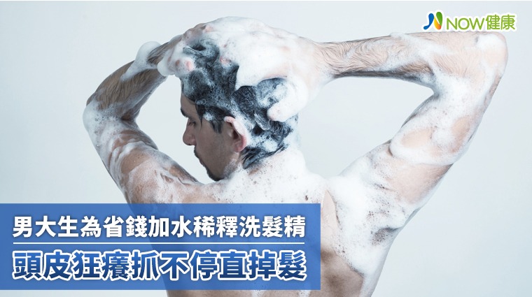 男大生為省錢加水稀釋洗髮精！ 頭皮狂癢抓不停直掉髮
