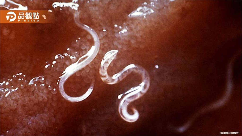 男愛種菜撿貓狗糞便施肥！遭鉤蟲寄生引發中風