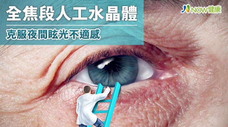 人工水晶體再進化 全焦段克服夜間眩光即將引進台灣