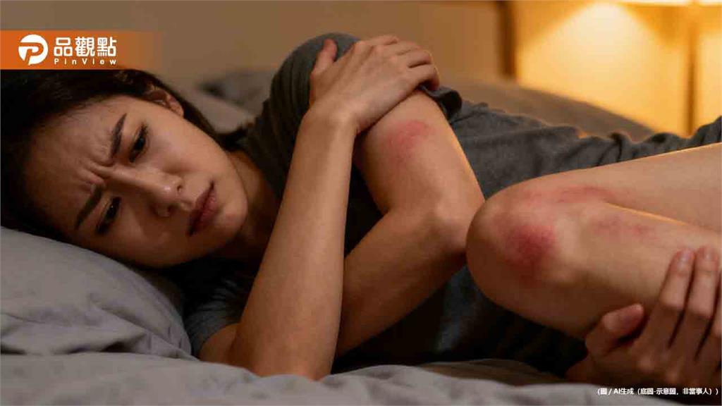 32歲女「全身超癢」夜夜難眠! 傳染力超強 一人中鏢全家遭殃