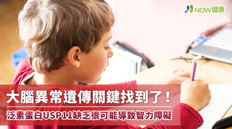 大腦異常遺傳關鍵找到了！原來是泛素蛋白USP11缺乏