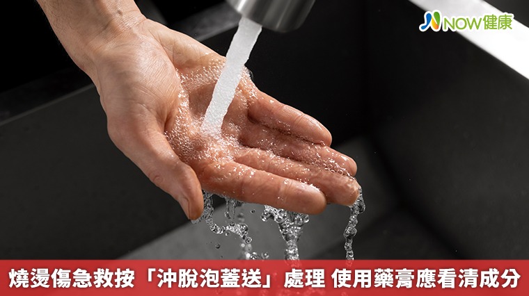 燒燙傷急救按「沖脫泡蓋送」處理　使用藥膏應看清成分