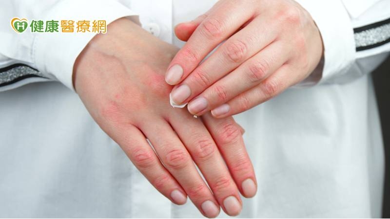 消毒手乾又痛！你可能中了皮膚炎　醫揭5大預警症狀