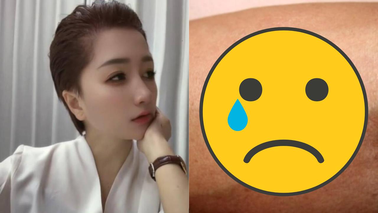 39歲網紅遭蟲咬病逝！疾管署急警「死亡率飆60％」台灣已56例確診