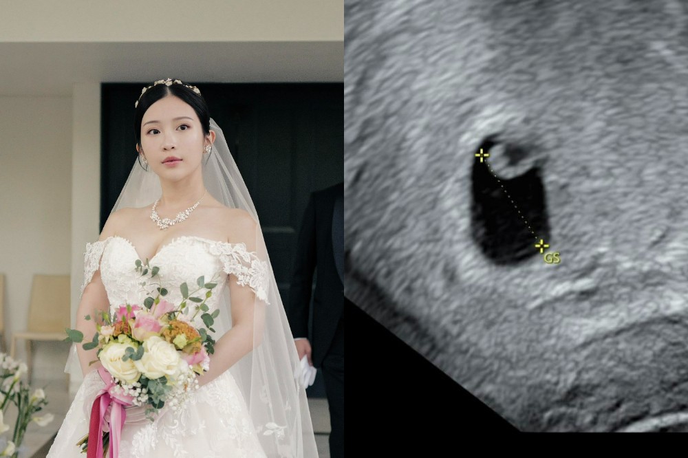 鄭家純懷孕9週不幸流產 發聲反對代理孕母合法化