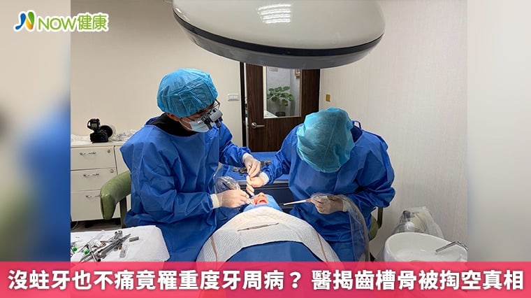沒蛀牙也不痛竟罹重度牙周病? 醫揭齒槽骨被掏空真相