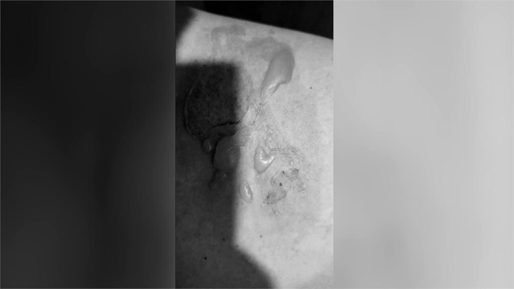 獨／星國男搭機點泡麵遭燙到起水泡　家屬怒控虎航不積極