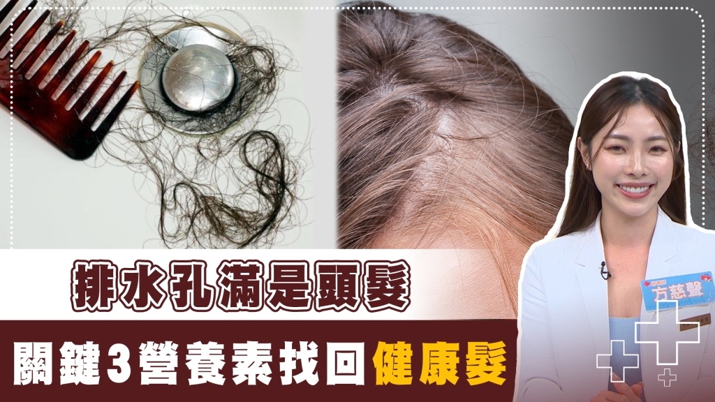 狂掉頭髮心慌慌!營養師教你這樣吃 從飲食補充3類救髮營養素