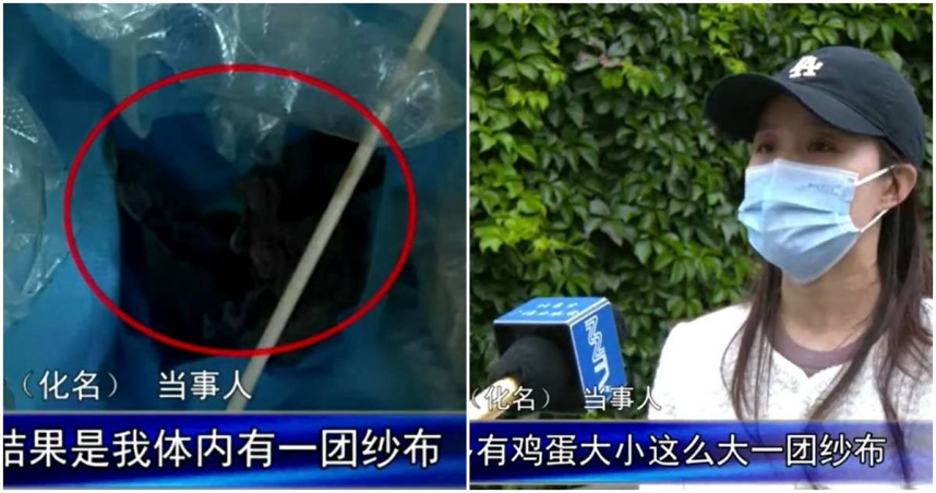 女子術後20天體內留一團發臭紗布　醫稱「小事」僅願賠4200元