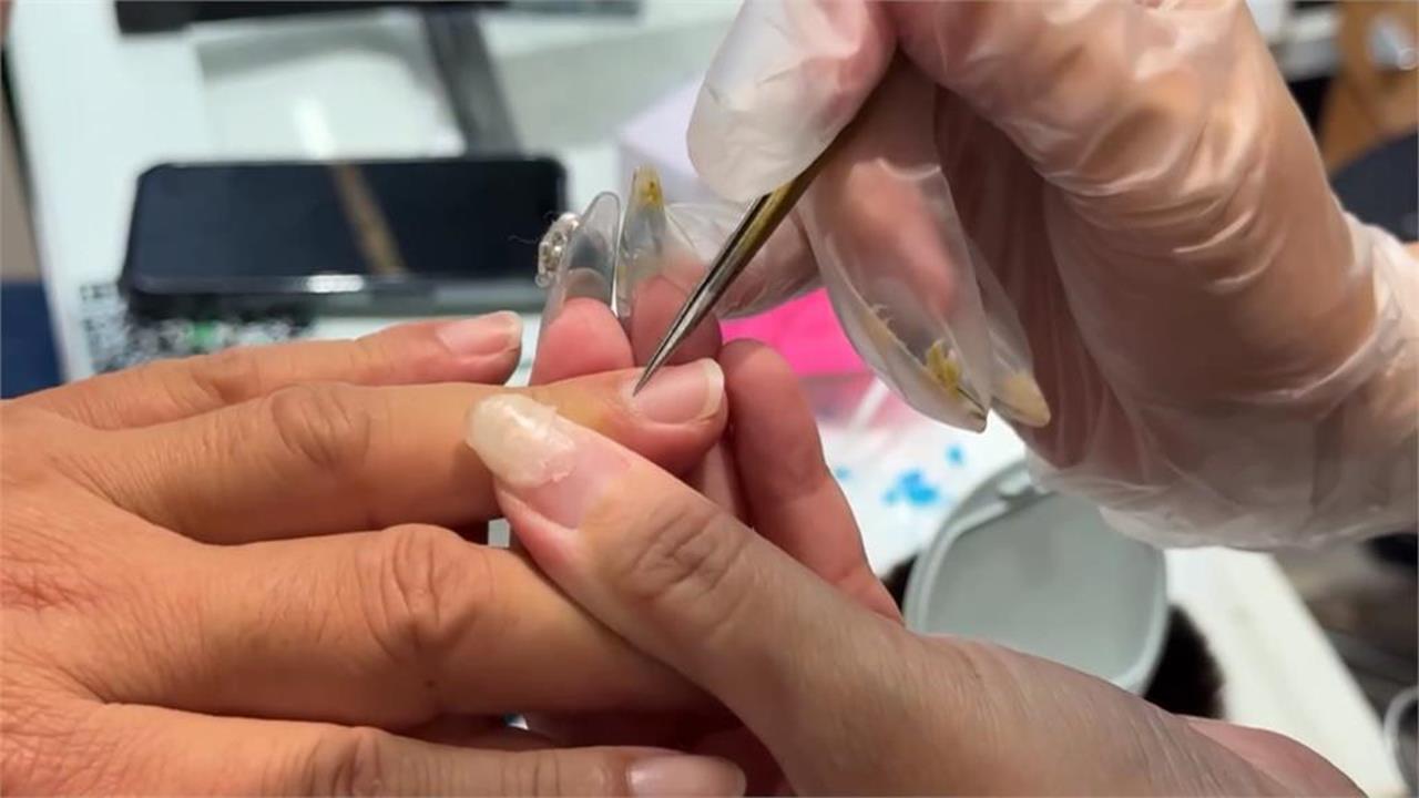 指甲易斷、有紋路竟是「身體的3大警訊」？醫曝補救「必吃菜單」