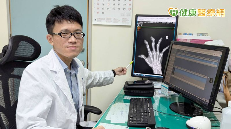 類風濕性關節炎別亂「補」！醫破迷思：這 3 種營養素要吃夠