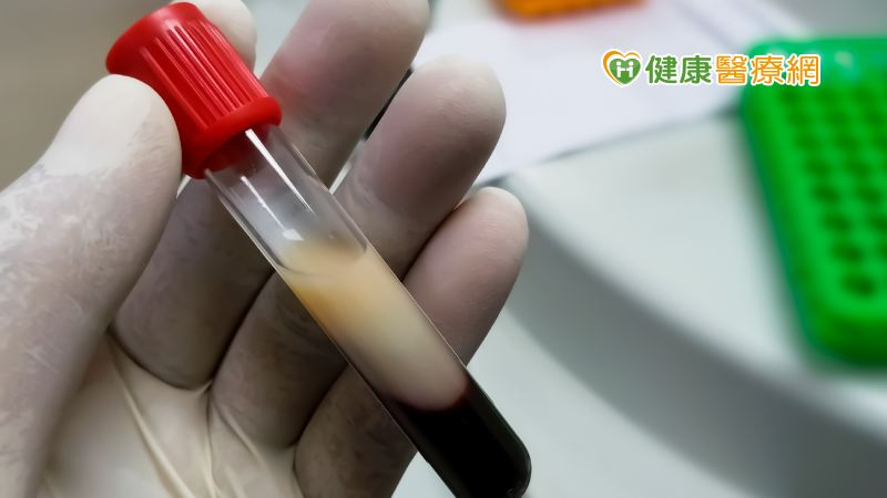 高血脂盛行率已達3成！　血脂要看哪些檢測指標？怎麼做才能有效控脂？