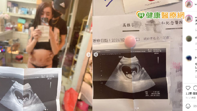跨性別網紅曬超音波照「稱懷孕」　高醫醫師說話了