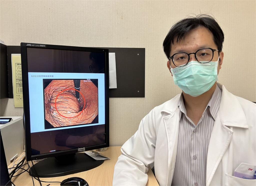 熟男「一種悶脹的感覺」半年不退   一照胃鏡竟6cm惡性腫瘤