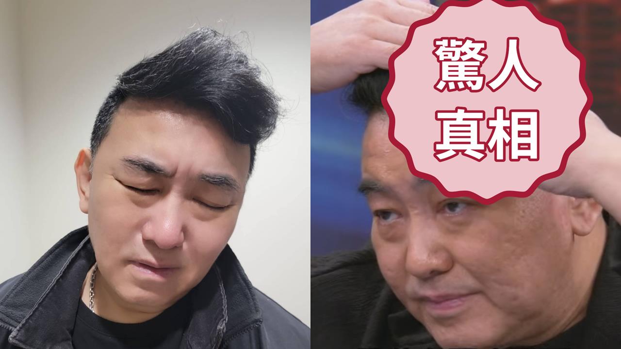 59歲徐亨長3cm腦瘤靠「1裝置維生」掀開嚇壞全場！親揭「不去中國發展」真相