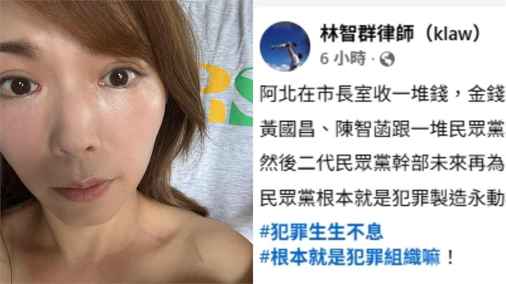 陳智菡曬傷照嗆「總統府變天安門」！律師曝她1舉動：民眾黨根本犯罪永動機