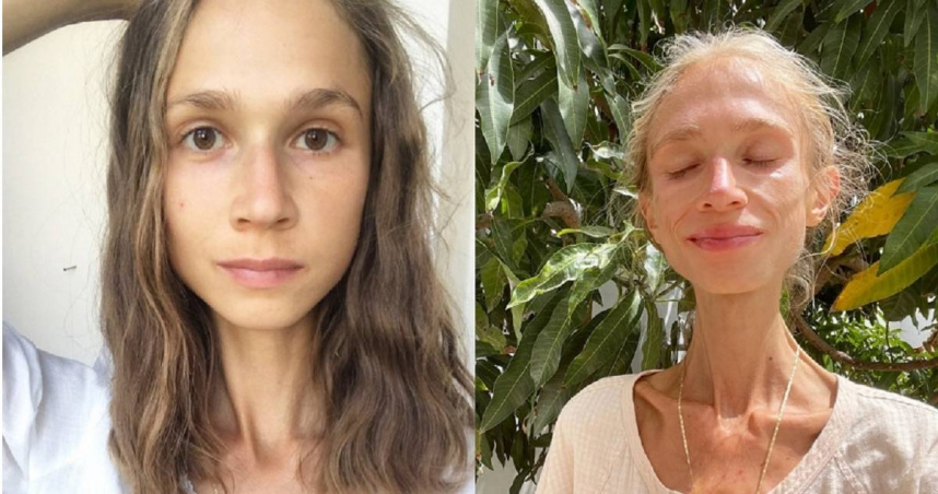 超極端素食者！27歲女只吃水果瘦成22kg紙片人　出國玩竟活活餓死