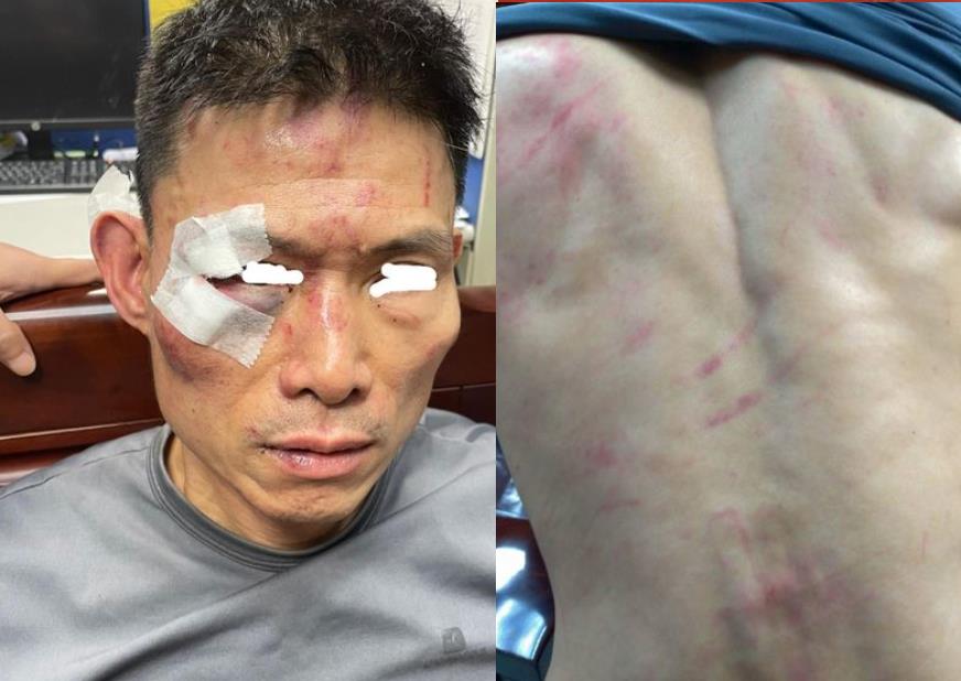 扯！新北警方「誤認通緝犯」  無辜男當街被拖行「打到全身是傷」