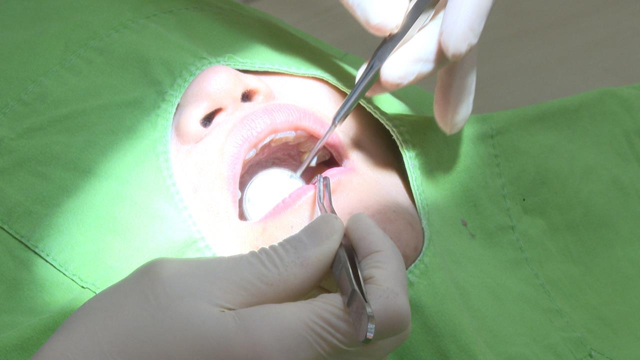 精準植牙時代來臨 「All-on-4」植牙十年維持率逾9成