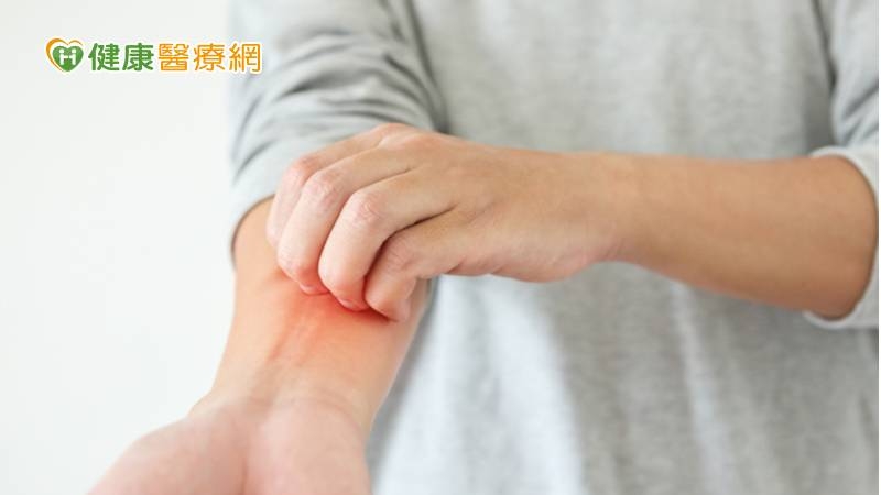 冬季癢又來亂！中醫：減少刺激、內服外用改善