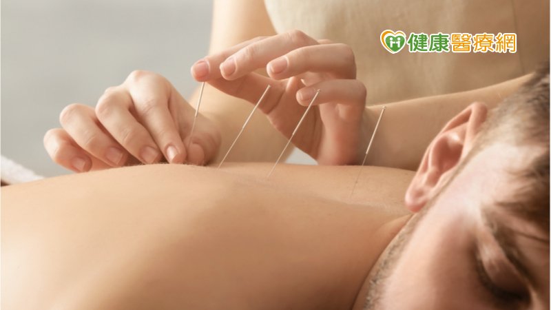 出現這些症狀恐為次發型頭痛！   中醫針灸緩解不適
