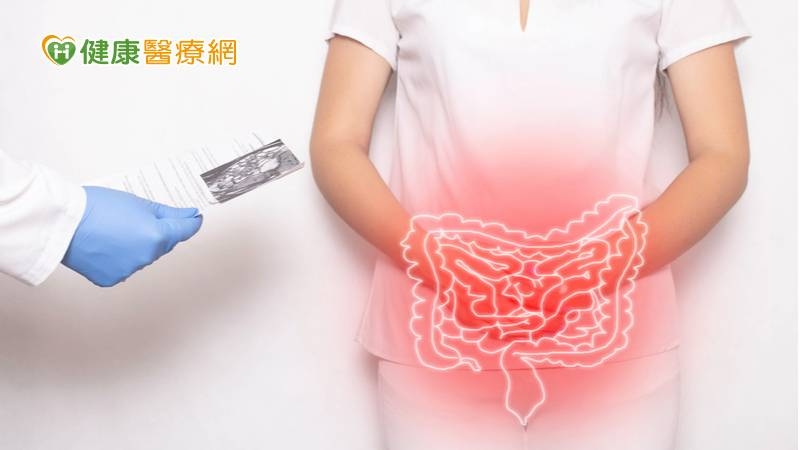 大腸癌出現症狀都中晚期了！醫籲「1招」降33%死亡率