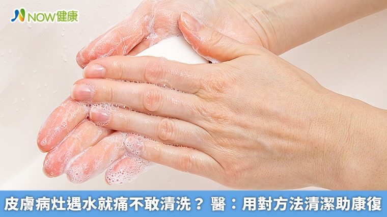 皮膚病灶遇水就痛不敢清洗？醫：用對方法清潔助康復