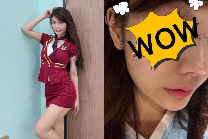 啦啦隊女神琳妲凌晨突發病痛！急衝醫院卻碰壁…曬照曝光真相嚇壞粉絲