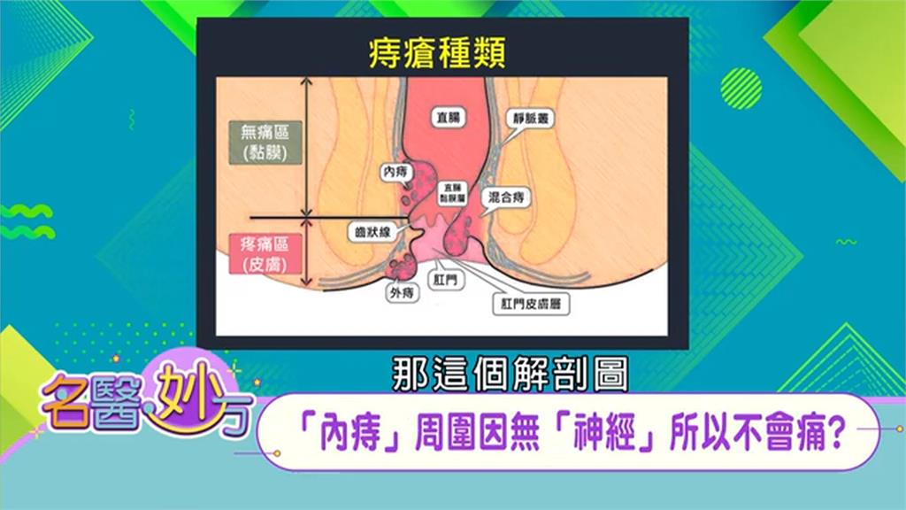 排便變細先別難過哭泣 趕緊就醫判斷到底是「大腸癌」還是內痔的第三、第四期!