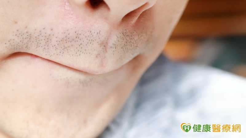 男鬍子變濃竟和「天天DIY」有關？　醫搖頭：2關鍵決定