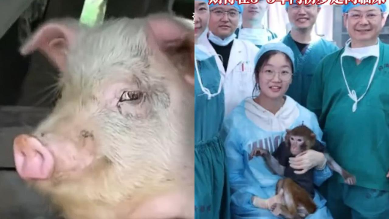「獼猴體內換上豬腎」活一年！中國異種器官移植畫面外流…醫生喊：人體移植倒數