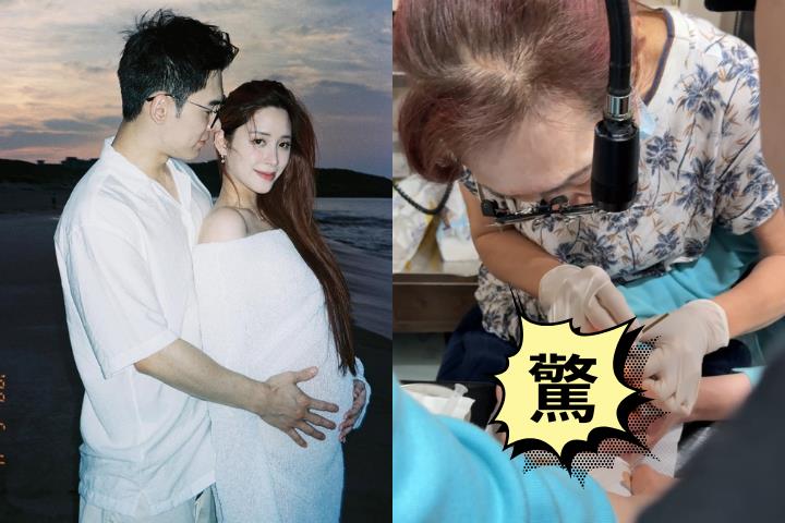 歐陽妮妮6月兒滿臉眼屎竟是「這症狀」 醫一看傻眼:再拖恐蜂窩性組織炎!