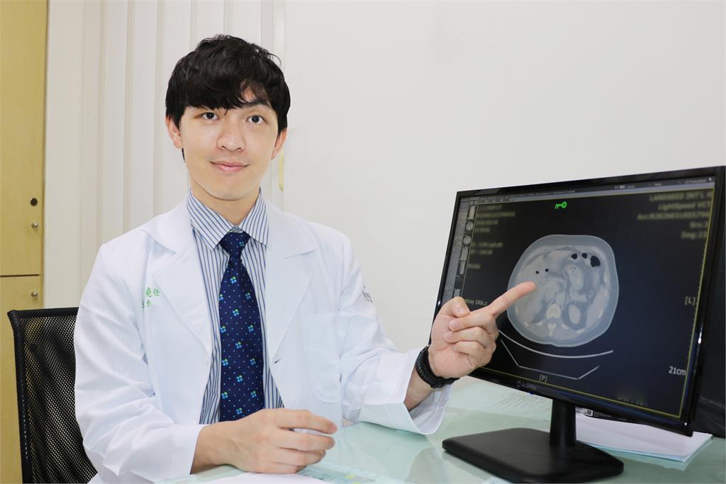 以為是胃脹氣!女子連續腹脹 聯新國際醫院診斷出罕見「膽源性腸阻塞」