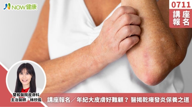 講座報名／年紀大皮膚好難顧？ 醫揭乾癢發炎保養之道