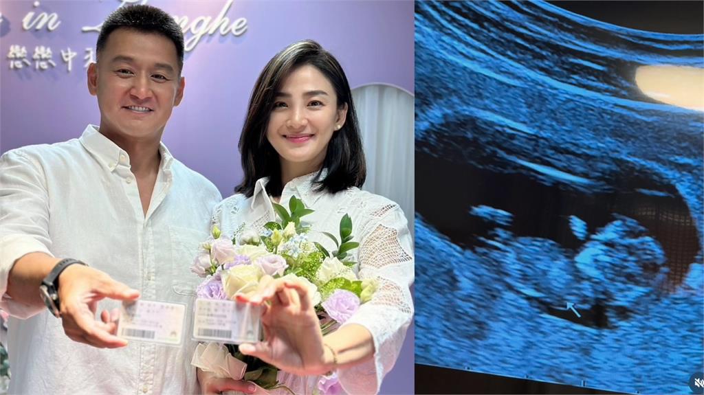 洪小鈴無預警宣布和張天霖結婚了！曝雙喜曬超音波照「三人成行必有我師」