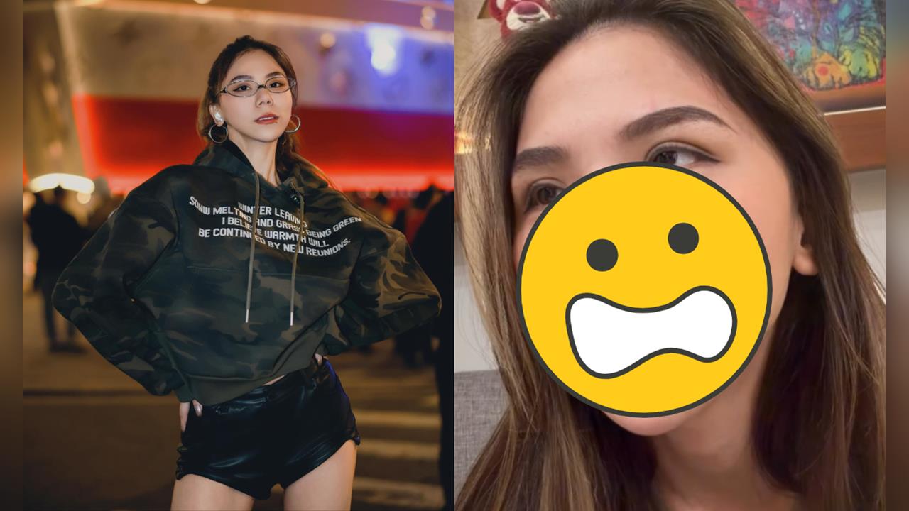 蕾菈遭突襲「半張臉被抓傷」險毀容!竟是「1片段惹事」驚悚過程曝:好扯…