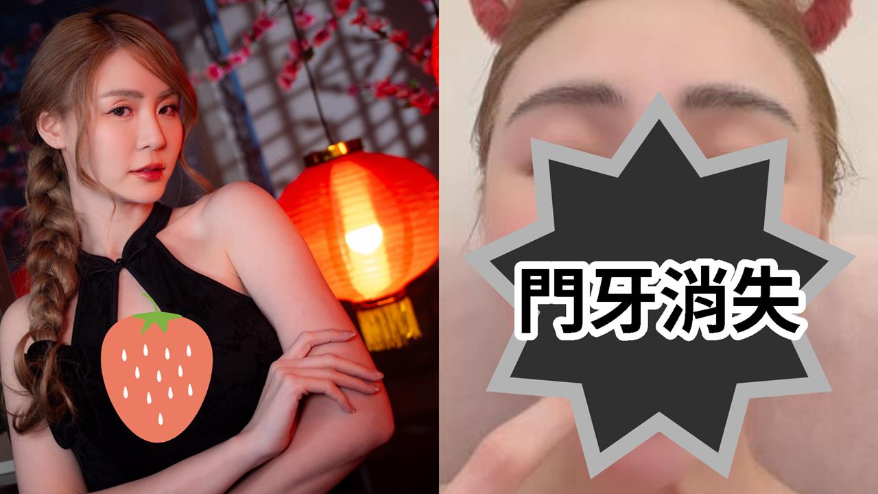 短今突PO「門牙缺一角」近距離照！竟是「吃飯吃進肚」…她崩潰喊：要瘋了