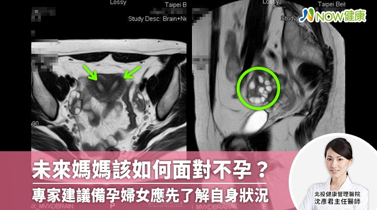 《未來媽媽》獲好評 專家建議備孕婦女應先做好這件事