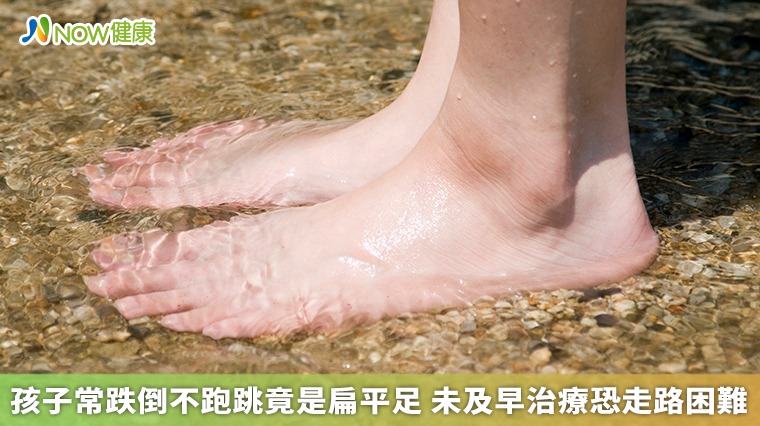 孩子常跌倒不愛跑跳竟是扁平足 未及早治療恐走路困難