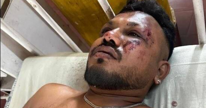 印度空難1人生還「飛機上座位曝光」！男子染血憶驚悚瞬間：周圍都是屍體