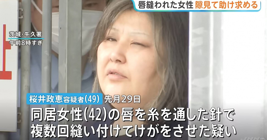 嘴唇被同居人用針線縫死！　日女逃到超商靠紙條「請救救我」求救