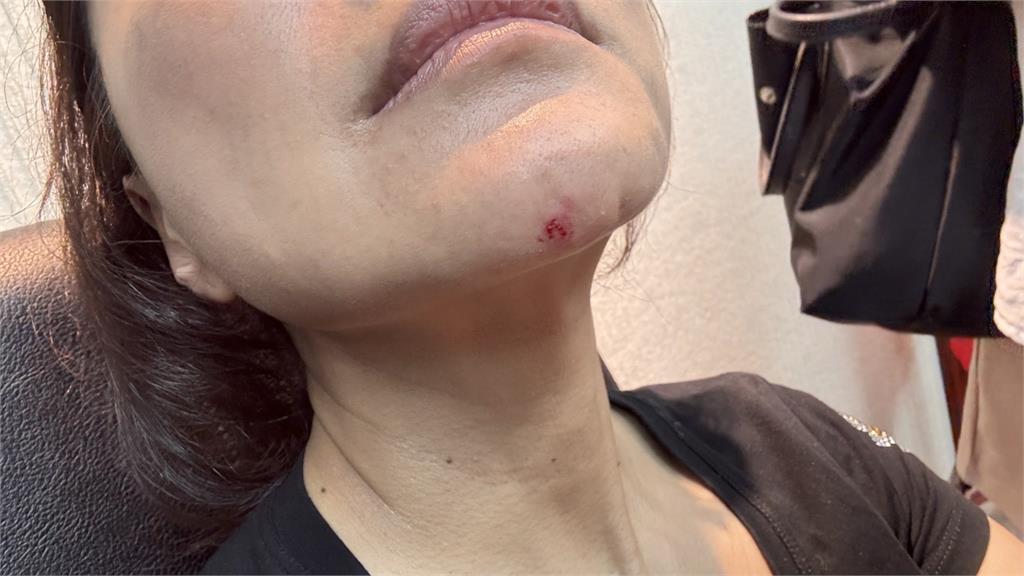快新聞／立院「上演全武行」！　王鴻薇狂毆林楚茵「下巴見血、緊急送醫」