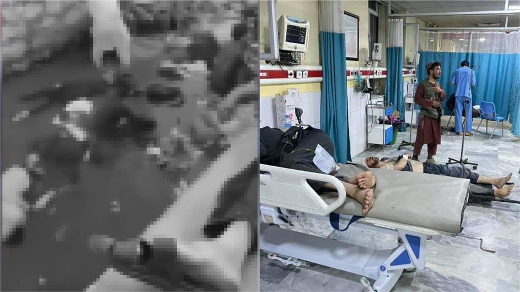 喀布爾恐攻釀百人死傷「醫院爆量」！患者躺地治療畫面曝光