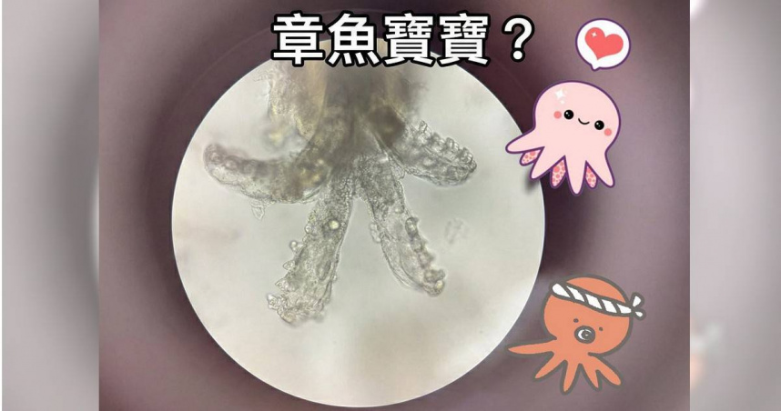 女大生狂冒痘！檢查驚見「章魚寶寶」大量繁殖　醫示警1行為：在餵蟲