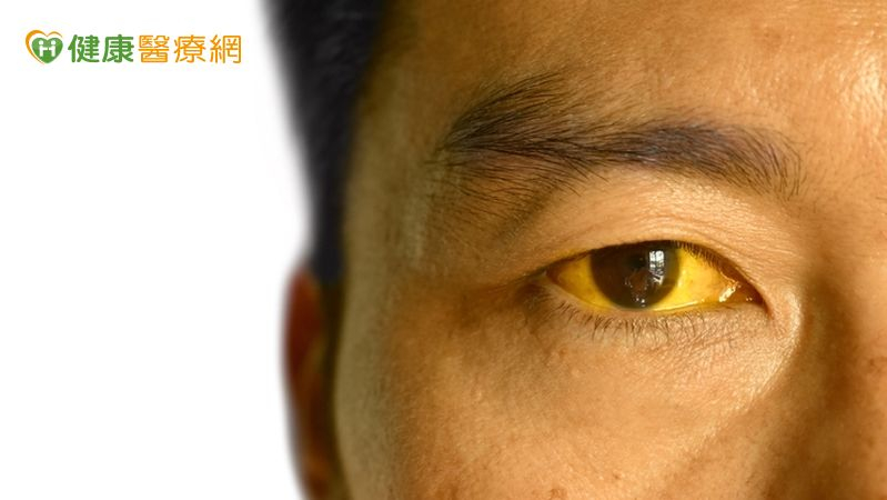 三餐不正常變「小小兵」　醫籲：這樣做避免養出結石