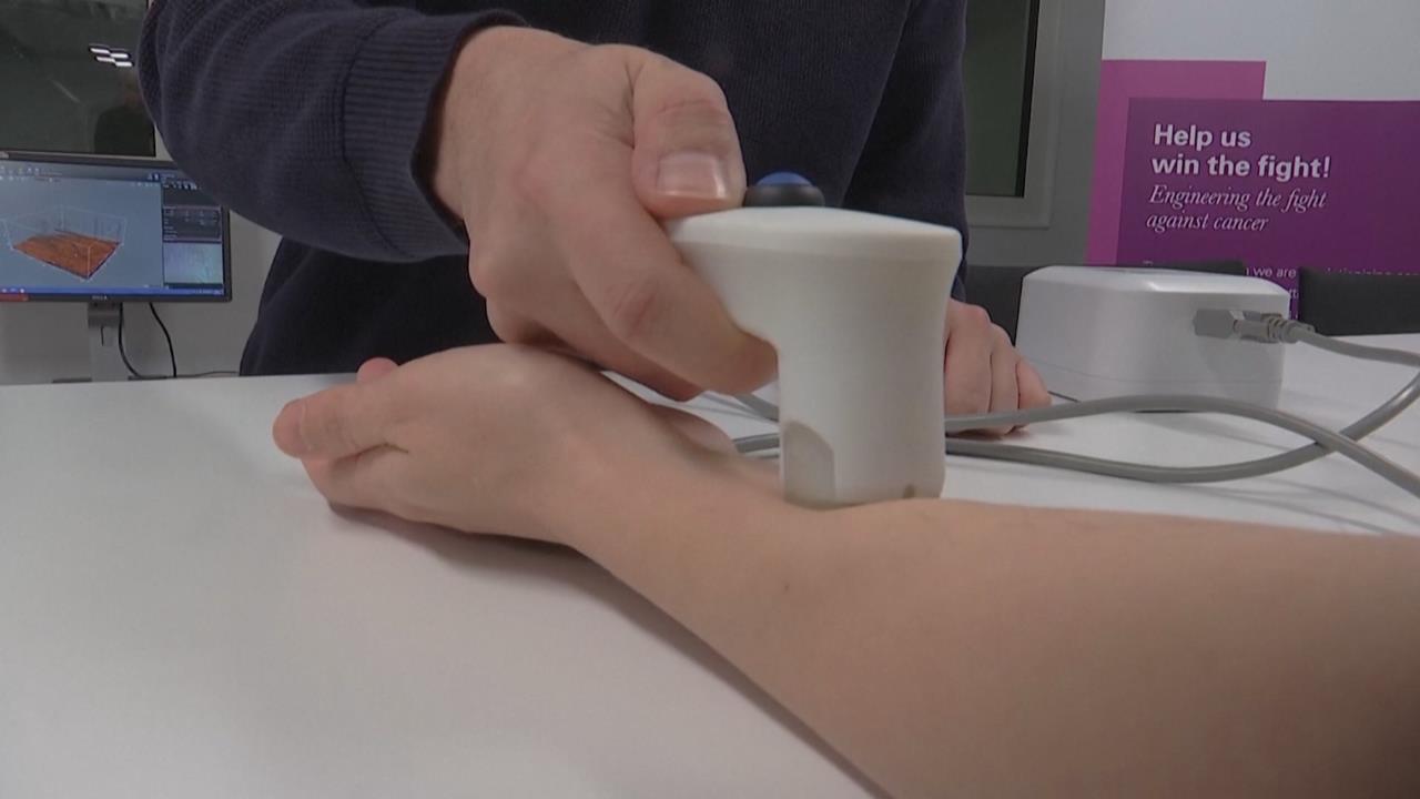 英國最新研發濕疹感測器　核心零件竟是兒童玩具蜂鳴器