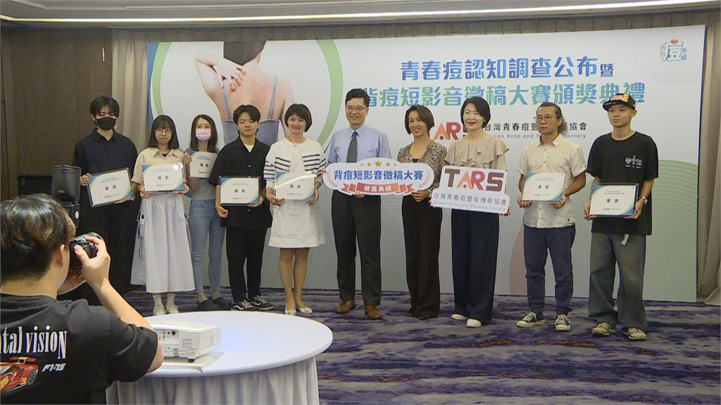 壓力、作息影響3成成人長「背痘」　醫生：及早治療效果越好