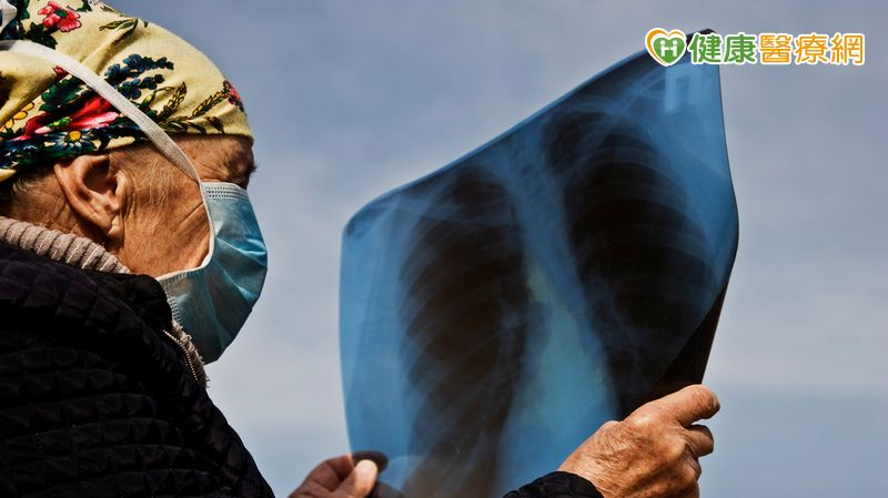 63歲男「１原因」接受肺癌早期偵測計畫　意外揪出第一期肺腺癌