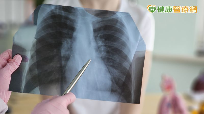 晚期EGFR突變型肺癌治療怎麼選？醫：大型臨床證據、治療指引是重要參考