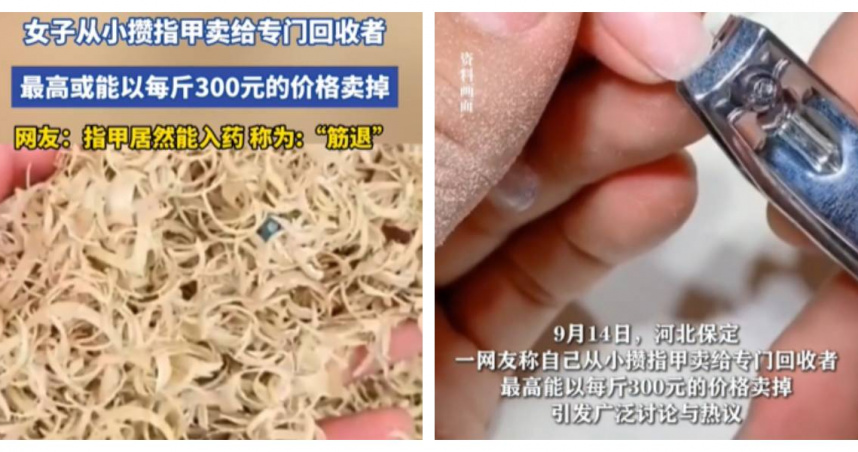 指甲能當傳統藥材？女子從小收集販售「最高1320元台幣」　專家揭入藥風險